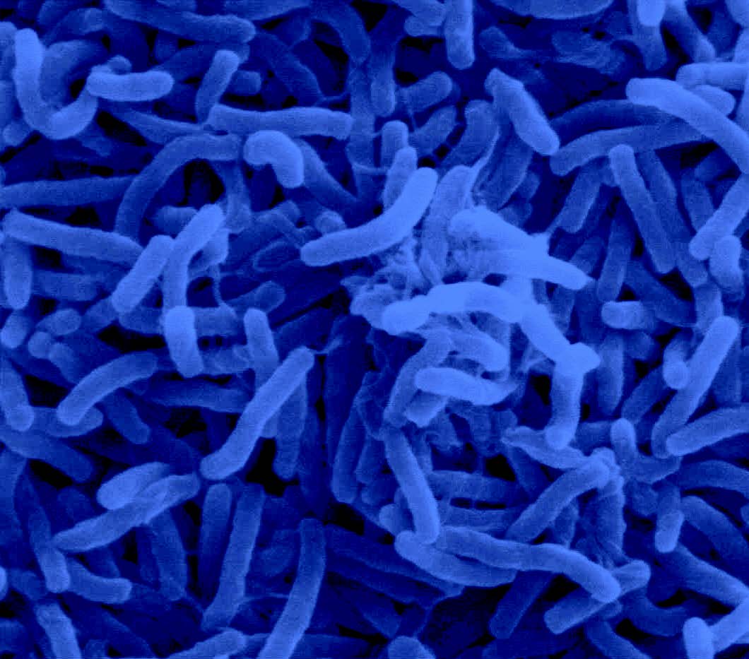 Микробы холеры